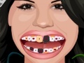 Játék Selena Gomez Perfect Teeth 