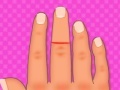 Játék Finger surgery