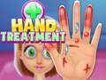 Játék Hand Treatment